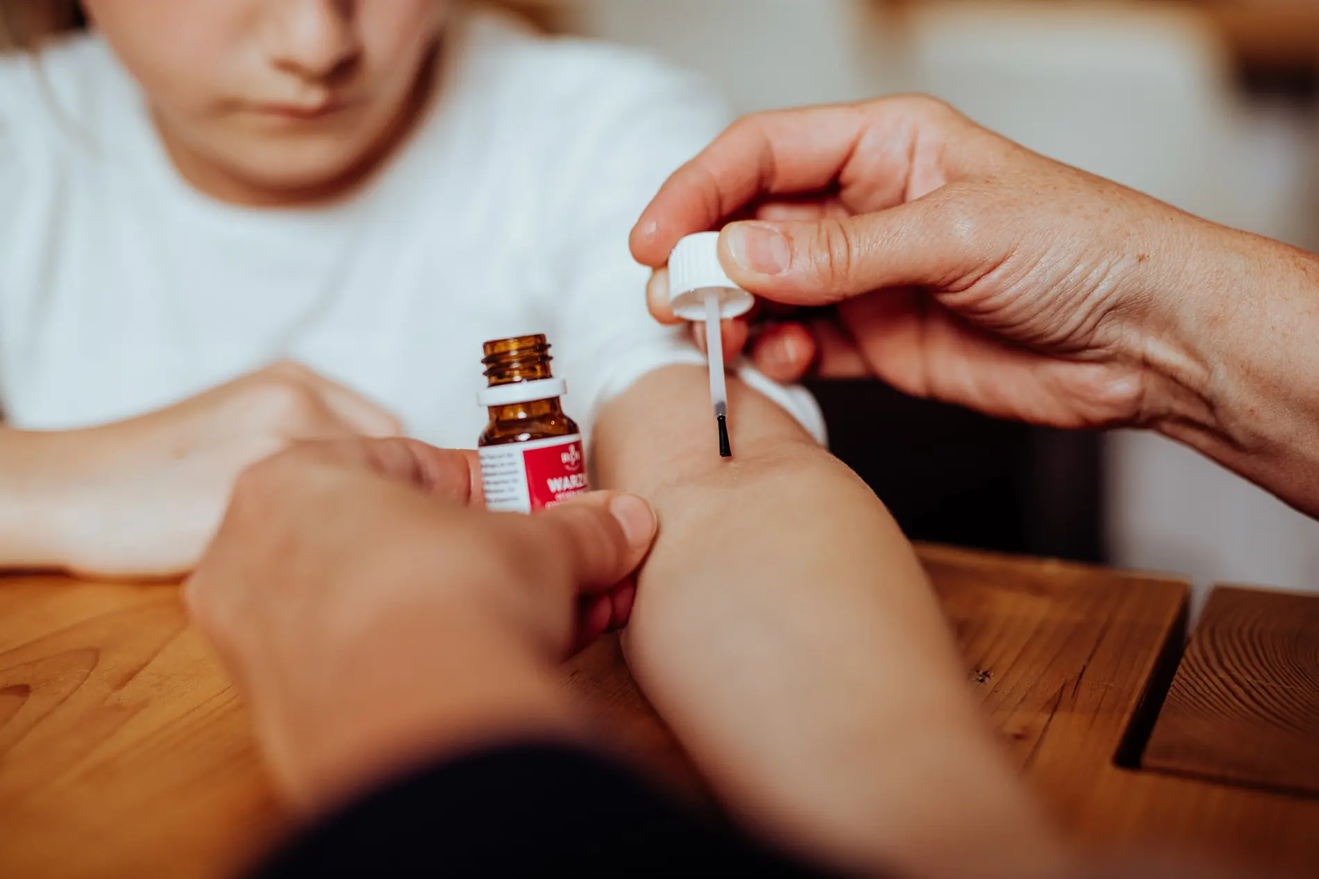 Warzin contro le verruche